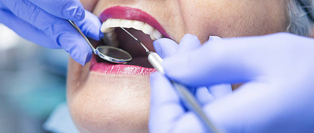 Best Emergency Tooth Extraction in Magee, MS
